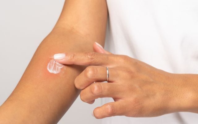 医療脱毛後に虫刺されができた際の対応方法