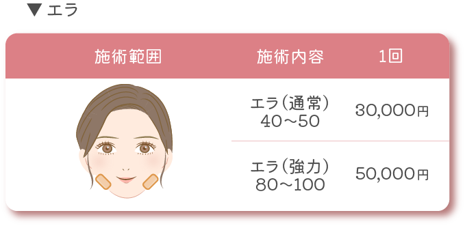 ボトックス料金3