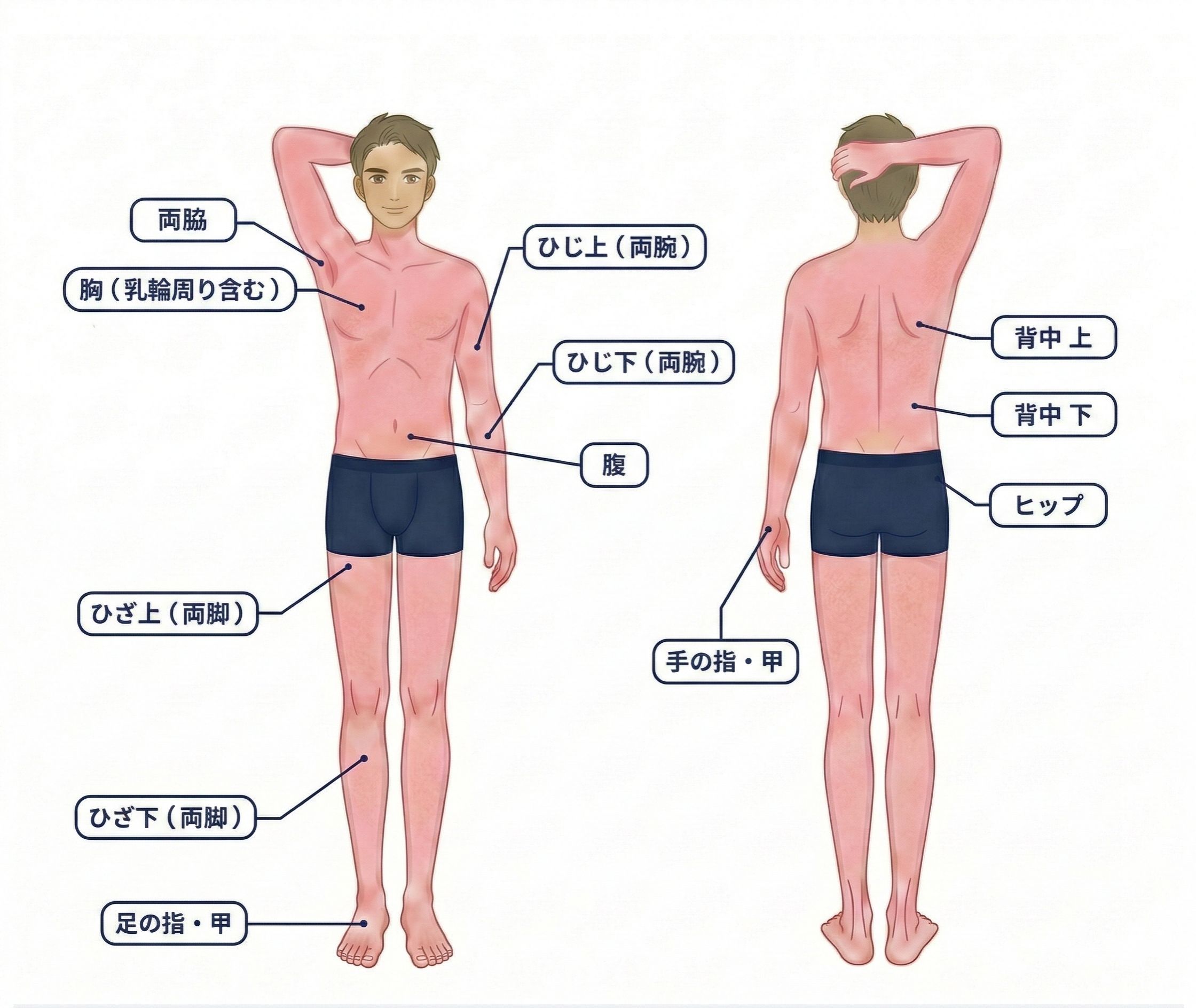ベーシック施術部位