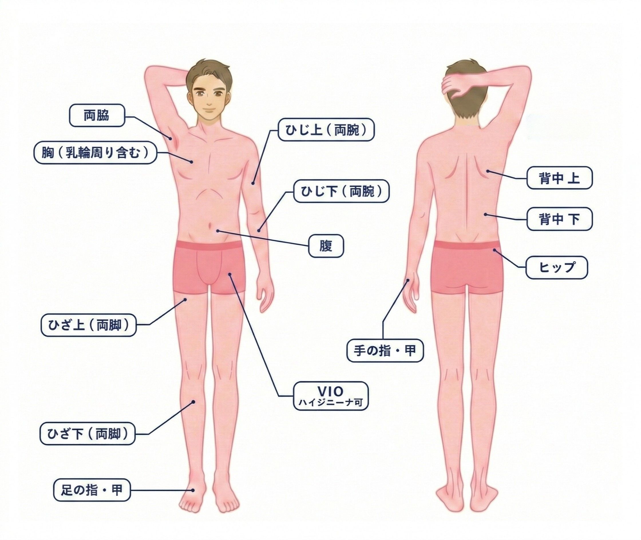 全身ライトコース(全身+VIO)