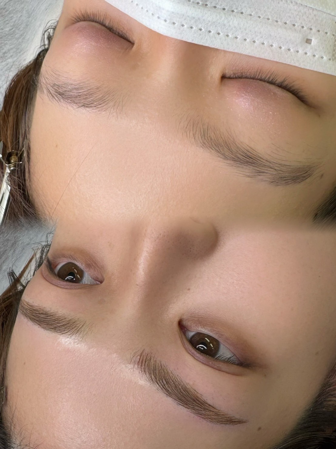 アートメイク症例12