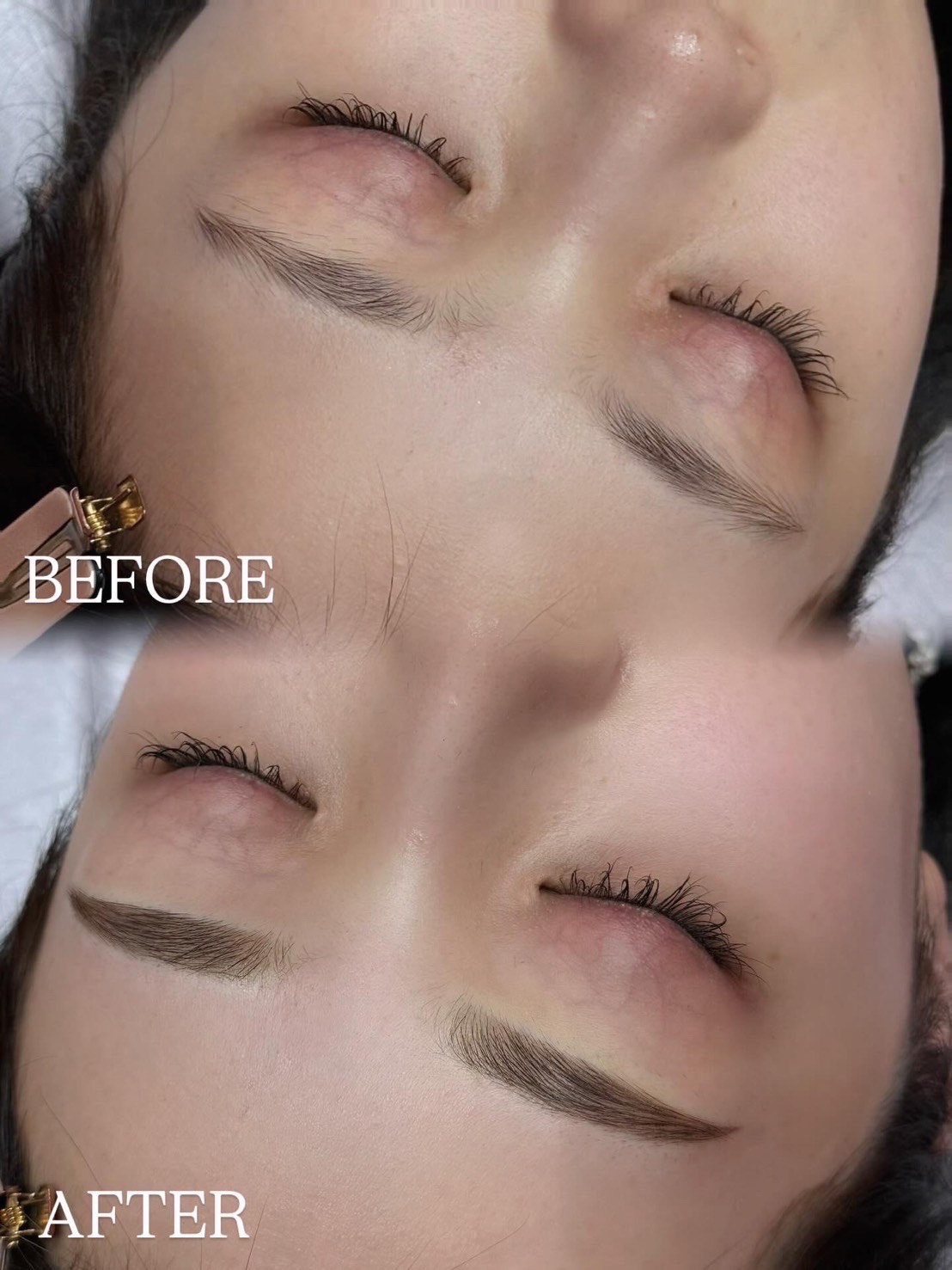 アートメイク症例10