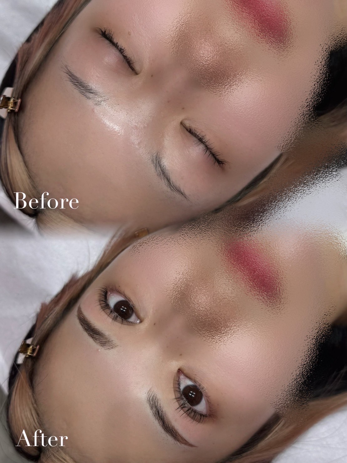 アートメイク症例9