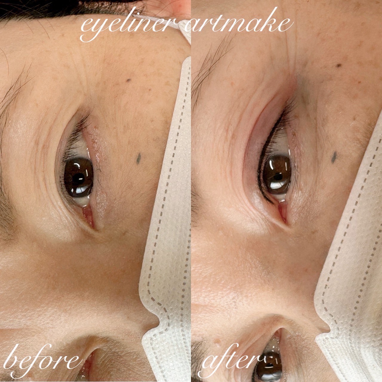 アートメイク症例11