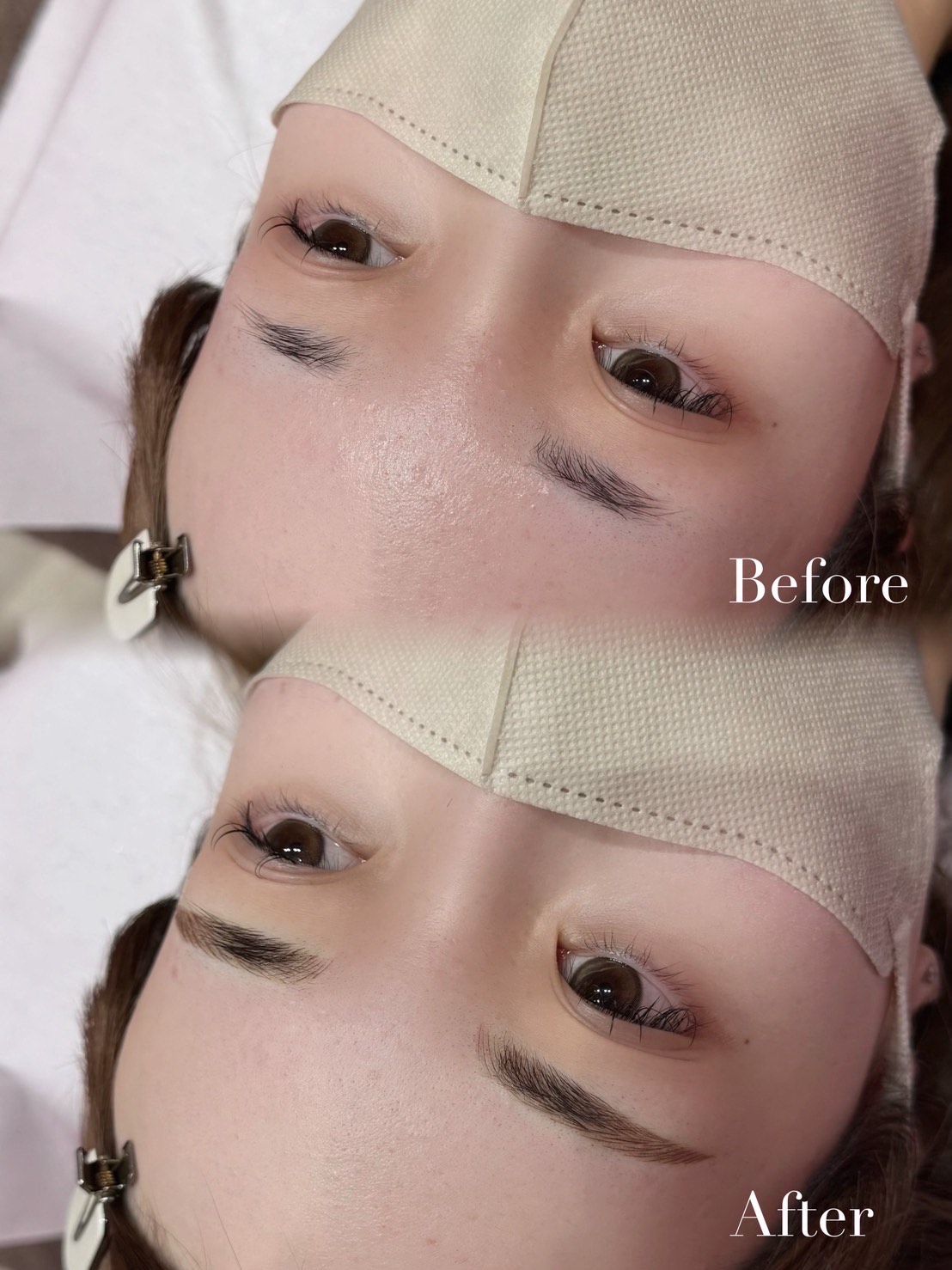 アートメイク症例6