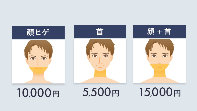 ひげ脱毛料金