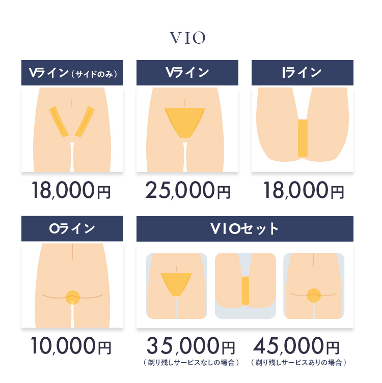 VIO脱毛料金